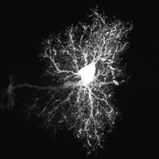  NCBI Organism:Rattus; Cell Types:astrocyte Cell Components:cell projection cytoplasm, cell body; Biological process:forebrain astrocyte development