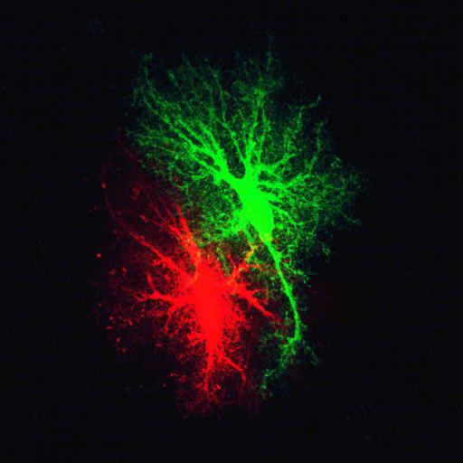  NCBI Organism:Rattus norvegicus; Cell Types:astrocyte Cell Components:cell projection cytoplasm, cell body; Biological process:forebrain astrocyte development, cell projection organization;