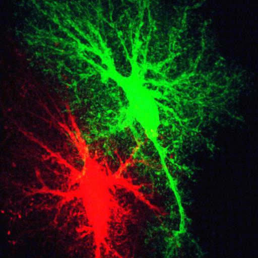  NCBI Organism:Rattus norvegicus; Cell Types:astrocyte Cell Components:cell projection cytoplasm, cell body; Biological process:forebrain astrocyte development, cell projection organization;