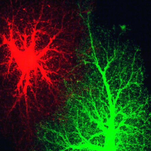  NCBI Organism:Rattus norvegicus; Cell Types:astrocyte Cell Components:cell projection cytoplasm, cell body; Biological process:forebrain astrocyte development, cell projection organization;