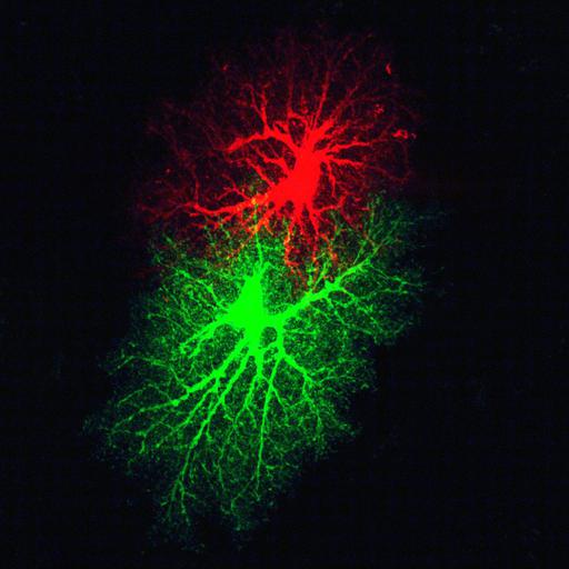  NCBI Organism:Rattus norvegicus; Cell Types:astrocyte Cell Components:cell projection cytoplasm, cell body; Biological process:forebrain astrocyte development, cell projection organization;