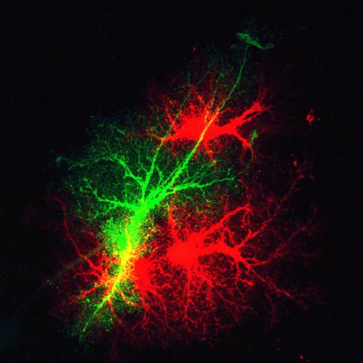  NCBI Organism:Rattus norvegicus; Cell Types:astrocyte Cell Components:cell projection cytoplasm, cell body; Biological process:forebrain astrocyte development, cell projection organization;