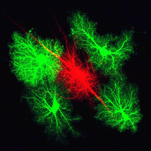  NCBI Organism:Rattus norvegicus; Cell Types:astrocyte Cell Components:cell projection cytoplasm, cell body; Biological process:forebrain astrocyte development, cell projection organization;