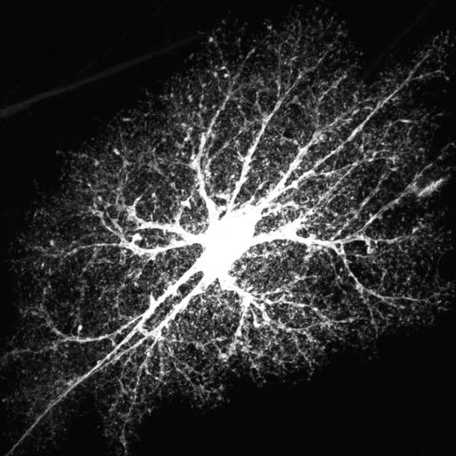  NCBI Organism:Rattus norvegicus; Cell Types:astrocyte, astrocyte of the hippocampus; Cell Components:cell projection cytoplasm, cell body; Biological process:forebrain astrocyte development, cell projection organization;