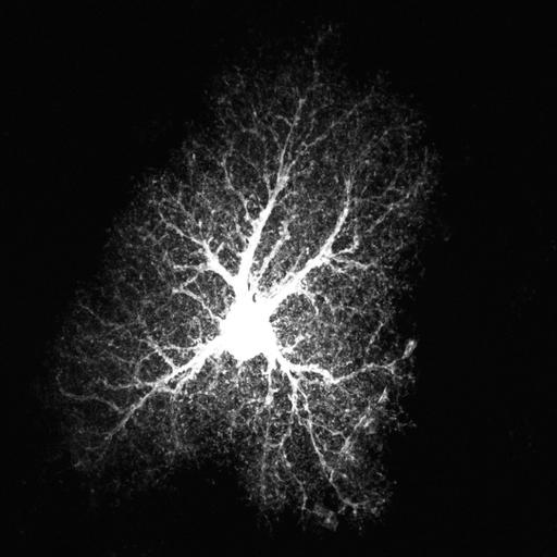  NCBI Organism:Rattus norvegicus; Cell Types:astrocyte, astrocyte of the hippocampus; Cell Components:cell projection cytoplasm, cell body; Biological process:forebrain astrocyte development, cell projection organization;