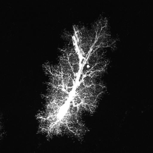  NCBI Organism:Rattus norvegicus; Cell Types:astrocyte, astrocyte of the hippocampus; Cell Components:cell projection cytoplasm, cell body; Biological process:forebrain astrocyte development, cell projection organization;