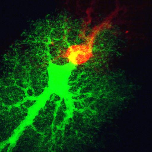  NCBI Organism:Rattus norvegicus; Cell Types:astrocyte Cell Components:cell projection cytoplasm, cell body; Biological process:forebrain astrocyte development, cell projection organization;