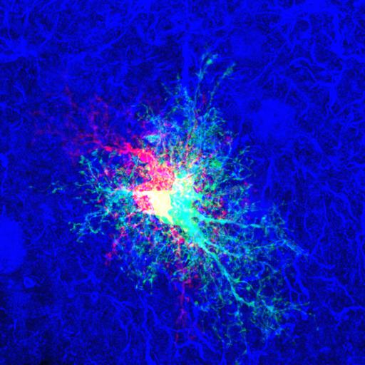  NCBI Organism:Rattus; Cell Types:astrocyte Cell Components:cell projection cytoplasm, cell body; Biological process:forebrain astrocyte development