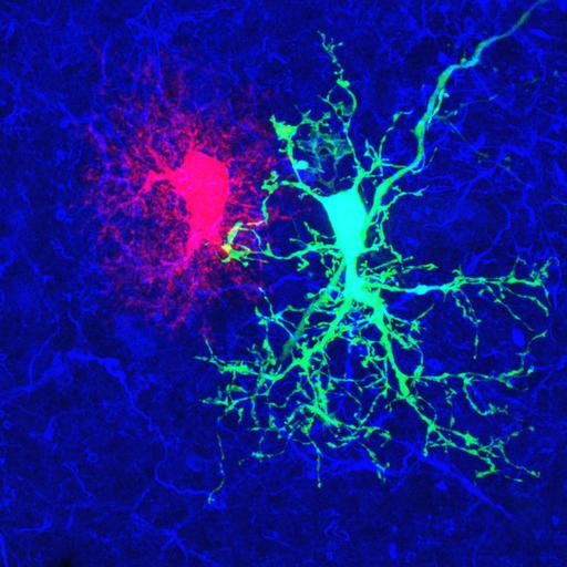  NCBI Organism:Rattus; Cell Types:astrocyte Cell Components:cell projection cytoplasm, cell body; Biological process:forebrain astrocyte development