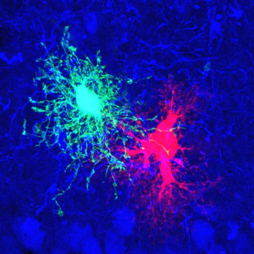  NCBI Organism:Rattus; Cell Types:astrocyte Cell Components:cell projection cytoplasm, cell body; Biological process:forebrain astrocyte development