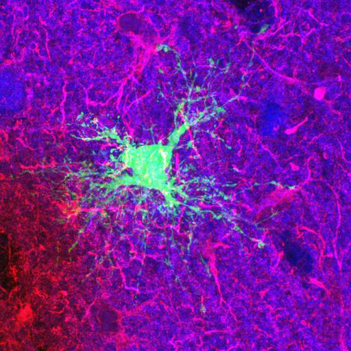  NCBI Organism:Rattus norvegicus; Cell Types:astrocyte of the hippocampus, astrocyte; Cell Components:cell projection cytoplasm, cell body; Biological process:forebrain astrocyte development, cell projection organization;