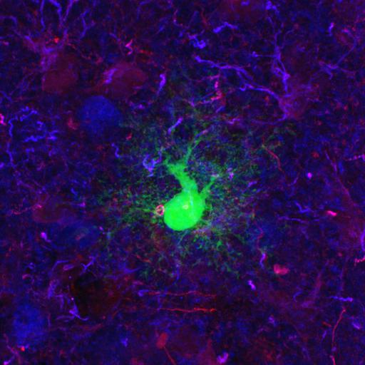  NCBI Organism:Rattus norvegicus; Cell Types:astrocyte of the hippocampus, astrocyte; Cell Components:cell projection cytoplasm, cell body; Biological process:forebrain astrocyte development, cell projection organization;