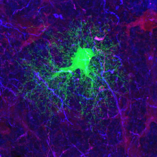  NCBI Organism:Rattus norvegicus; Cell Types:astrocyte of the hippocampus, astrocyte; Cell Components:cell projection cytoplasm, cell body; Biological process:forebrain astrocyte development, cell projection organization;