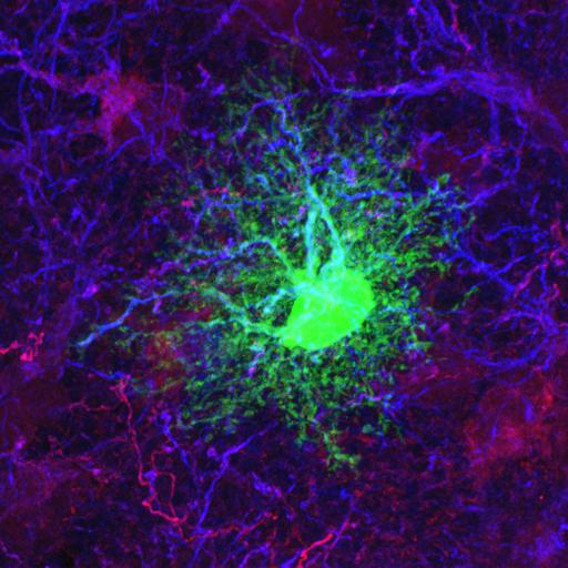  NCBI Organism:Rattus norvegicus; Cell Types:astrocyte of the hippocampus, astrocyte; Cell Components:cell projection cytoplasm, cell body; Biological process:forebrain astrocyte development, cell projection organization;