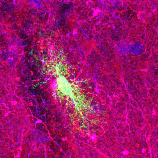  NCBI Organism:Rattus norvegicus; Cell Types:astrocyte of the hippocampus, astrocyte; Cell Components:cell projection cytoplasm, cell body; Biological process:forebrain astrocyte development, cell projection organization;