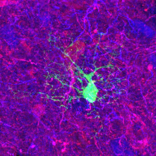  NCBI Organism:Rattus norvegicus; Cell Types:astrocyte of the hippocampus, astrocyte; Cell Components:cell projection cytoplasm, cell body; Biological process:forebrain astrocyte development, cell projection organization;