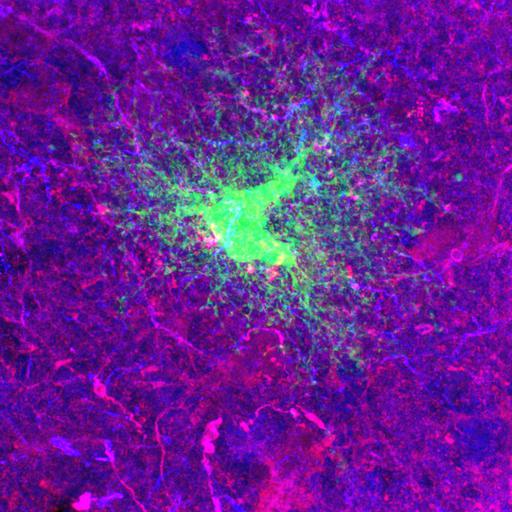  NCBI Organism:Rattus norvegicus; Cell Types:astrocyte of the hippocampus, astrocyte; Cell Components:cell projection cytoplasm, cell body; Biological process:forebrain astrocyte development, cell projection organization;