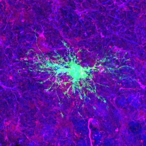  NCBI Organism:Rattus norvegicus; Cell Types:astrocyte of the hippocampus, astrocyte; Cell Components:cell projection cytoplasm, cell body; Biological process:forebrain astrocyte development, cell projection organization;