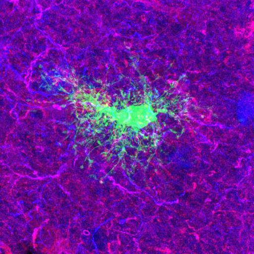  NCBI Organism:Rattus norvegicus; Cell Types:astrocyte of the hippocampus, astrocyte; Cell Components:cell projection cytoplasm, cell body; Biological process:forebrain astrocyte development, cell projection organization;