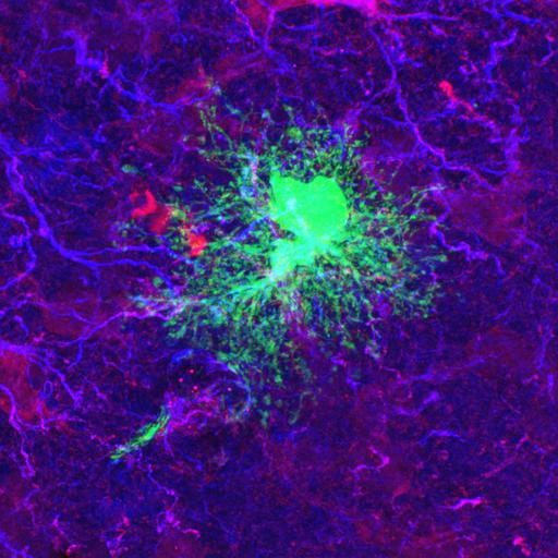  NCBI Organism:Rattus norvegicus; Cell Types:astrocyte of the hippocampus, astrocyte; Cell Components:cell projection cytoplasm, cell body; Biological process:forebrain astrocyte development, cell projection organization;