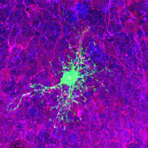  NCBI Organism:Rattus norvegicus; Cell Types:astrocyte of the hippocampus, astrocyte; Cell Components:cell projection cytoplasm, cell body; Biological process:forebrain astrocyte development, cell projection organization;