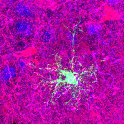  NCBI Organism:Rattus norvegicus; Cell Types:astrocyte of the hippocampus, astrocyte; Cell Components:cell projection cytoplasm, cell body; Biological process:forebrain astrocyte development, cell projection organization;