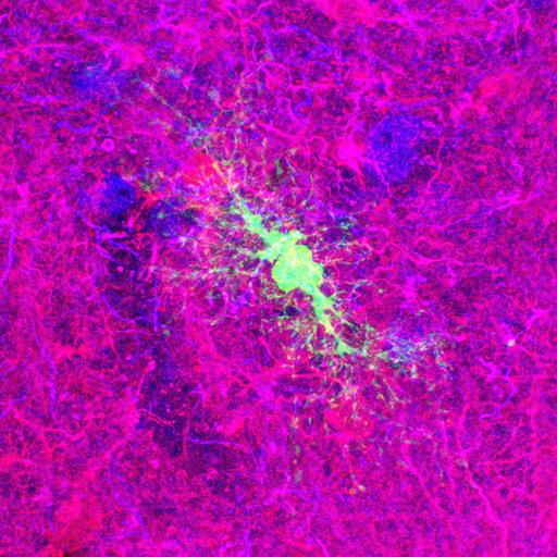  NCBI Organism:Rattus norvegicus; Cell Types:astrocyte of the hippocampus, astrocyte; Cell Components:cell projection cytoplasm, cell body; Biological process:forebrain astrocyte development, cell projection organization;