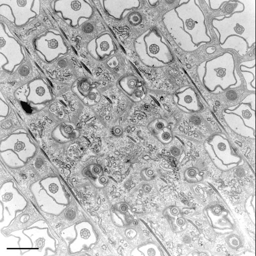  NCBI Organism:Paramecium multimicronucleatum; Cell Types:cell by organism, eukaryotic cell, , ; Cell Components:pellicle, cell cortex, coated pit, plasma membrane; Biological process:plasma membrane organization, cortical cytoskeleton organization, endocytosis;