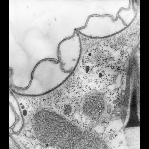  NCBI Organism:Paramecium multimicronucleatum; Cell Types:cell by organism, eukaryotic cell, , ; Cell Components:pellicle, cell cortex; Biological process:plasma membrane organization, cortical cytoskeleton organization;