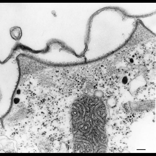  NCBI Organism:Paramecium multimicronucleatum; Cell Types:cell by organism, eukaryotic cell, , ; Cell Components:pellicle, cell cortex; Biological process:plasma membrane organization, cortical cytoskeleton organization;