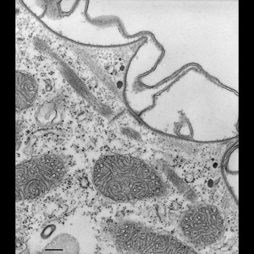  NCBI Organism:Paramecium multimicronucleatum; Cell Types:cell by organism, eukaryotic cell, , ; Cell Components:pellicle, cell cortex; Biological process:plasma membrane organization, cortical cytoskeleton organization;