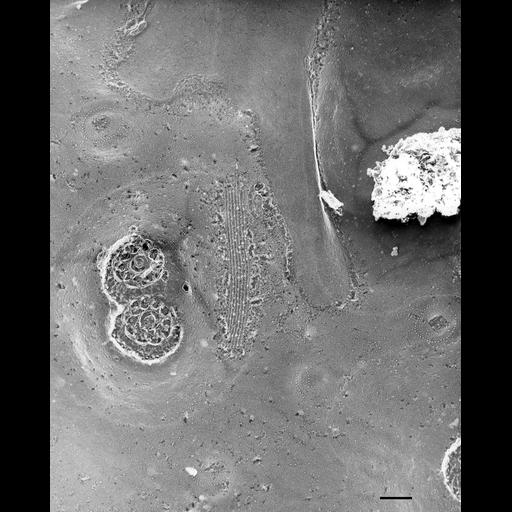  NCBI Organism:Paramecium multimicronucleatum; Cell Types:cell by organism, eukaryotic cell, , ; Cell Components:plasma membrane, trichocyst, , pellicle; Biological process:plasma membrane organization