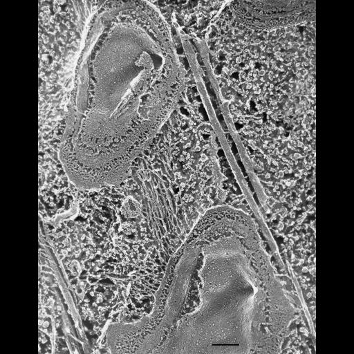  NCBI Organism:Paramecium multimicronucleatum; Cell Types:cell by organism, eukaryotic cell, , ; Cell Components:pellicle, cell cortex; Biological process:endomembrane system organization, cortical cytoskeleton organization;