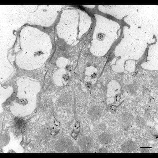  NCBI Organism:Paramecium multimicronucleatum; Cell Types:cell by organism, eukaryotic cell, , ; Cell Components:cell cortex, microtubule basal body, microtubule associated complex; Biological process:cortical cytoskeleton organization