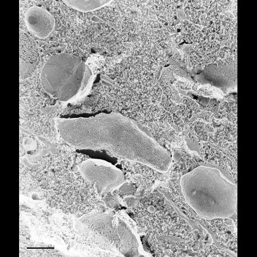  NCBI Organism:Paramecium multimicronucleatum; Cell Types:cell by organism, eukaryotic cell, , ; Cell Components:endoplasmic reticulum Biological process:endoplasmic reticulum organization