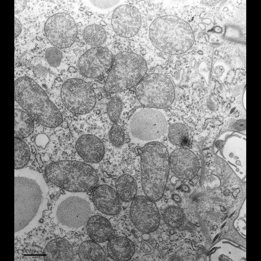  NCBI Organism:Paramecium multimicronucleatum; Cell Types:cell by organism, eukaryotic cell, , ; Cell Components:mitochondrion, cytoplasm; Biological process:mitochondrion organization, cytoplasm organization;