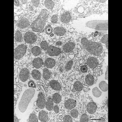  NCBI Organism:Paramecium multimicronucleatum; Cell Types:cell by organism, eukaryotic cell, , ; Cell Components:mitochondrion, trichocyst, cytoplasm; Biological process:inner mitochondrial membrane organization, cytoplasm organization;