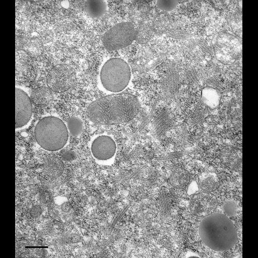  NCBI Organism:Paramecium multimicronucleatum; Cell Types:cell by organism, eukaryotic cell, , ; Cell Components:mitochondrion, contractile vacuole, integral to contractile vacuolar membrane; Biological process:mitochondrial proton-transporting ATP synthase complex assembly, vacuolar proton-transporting V-type ATPase complex assembly;