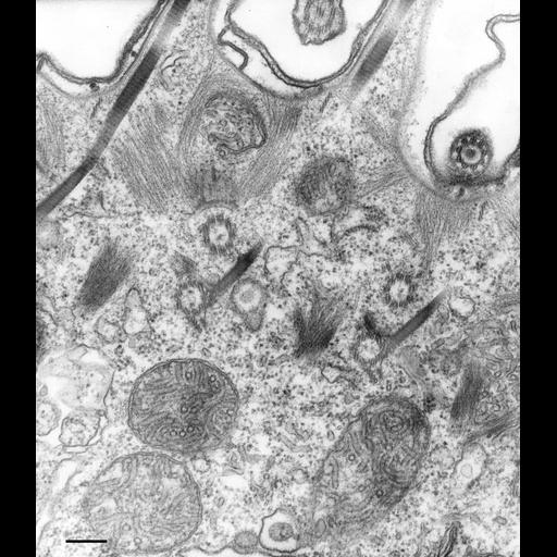  NCBI Organism:Paramecium multimicronucleatum; Cell Types:cell by organism, eukaryotic cell, , ; Cell Components:mitochondrion, cell cortex, cilium, microtubule basal body, sodium ion-transporting F-type ATPase complex; Biological process:mitochondrial ATP synthesis coupled electron transport, mitochondrion organization, cortical cytoskeleton organization;