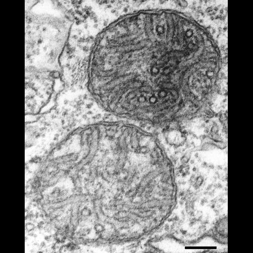  NCBI Organism:Paramecium multimicronucleatum; Cell Types:cell by organism, eukaryotic cell, , ; Cell Components:mitochondrion, mitochondrial membrane;