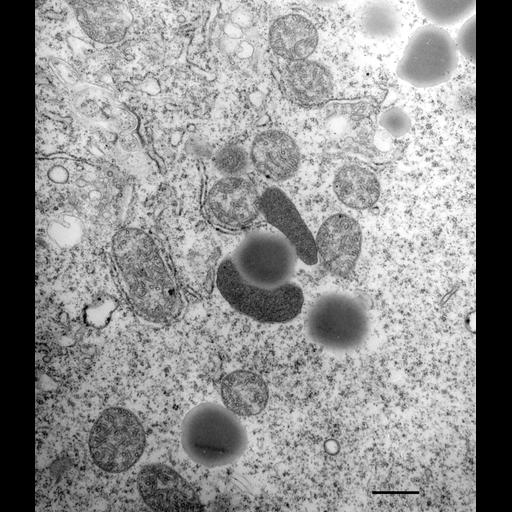  NCBI Organism:Paramecium multimicronucleatum; Cell Types:cell by organism, eukaryotic cell, , ; Cell Components:peroxisome, cytoplasm; Biological process:peroxisome organization, cytoplasm organization;