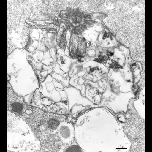  NCBI Organism:Paramecium multimicronucleatum; Cell Types:cell by organism, eukaryotic cell, , ; Cell Components:crystalloid, cytoplasm; Biological process:cytoplasm organization