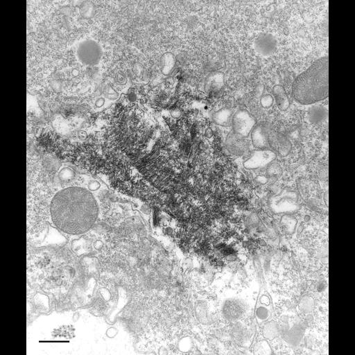  NCBI Organism:Paramecium multimicronucleatum; Cell Types:cell by organism, eukaryotic cell, , ; Cell Components:crystalloid, secondary lysosome, cytoplasm; Biological process:lysosome organization, cytoplasm organization;