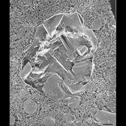  NCBI Organism:Paramecium multimicronucleatum; Cell Types:cell by organism, eukaryotic cell, , ; Cell Components:crystalloid, mitochondrion, trichocyst; Biological process:cytoplasm organization