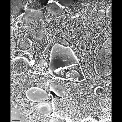  NCBI Organism:Paramecium multimicronucleatum; Cell Types:cell by organism, eukaryotic cell, , ; Cell Components:crystalloid, trichocyst; Biological process:organelle organization