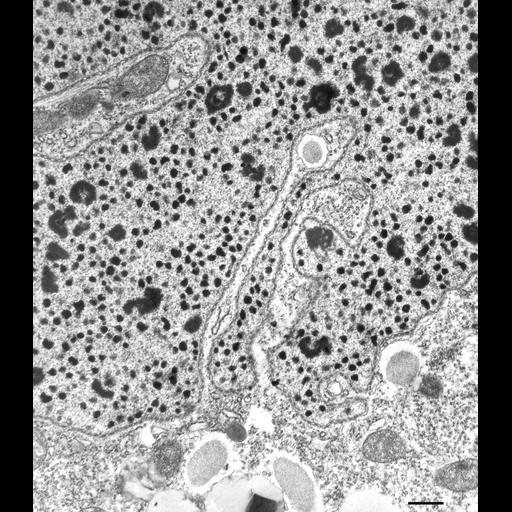  NCBI Organism:Paramecium multimicronucleatum; Cell Types:cell by organism, eukaryotic cell, , ; Cell Components:macronucleus, nuclear pore, nucleolus, cytoplasm; Biological process:macronucleus organization, nuclear pore organization, nucleolus organization, cytoplasm organization;