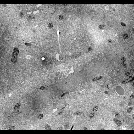  NCBI Organism:Paramecium multimicronucleatum; Cell Types:cell by organism, eukaryotic cell, , ; Cell Components:micronucleus Biological process:nuclear division