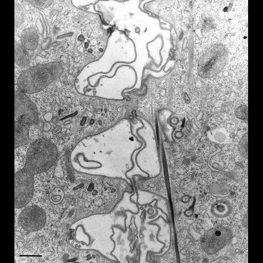  NCBI Organism:Paramecium multimicronucleatum; Cell Types:cell by organism, eukaryotic cell, , ; Cell Components:cell-cell contact zone Biological process:conjugation