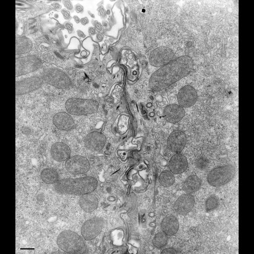  NCBI Organism:Paramecium multimicronucleatum; Cell Types:cell by organism, eukaryotic cell, , ; Cell Components:cell-cell contact zone Biological process:conjugation, conjugation with cellular fusion;