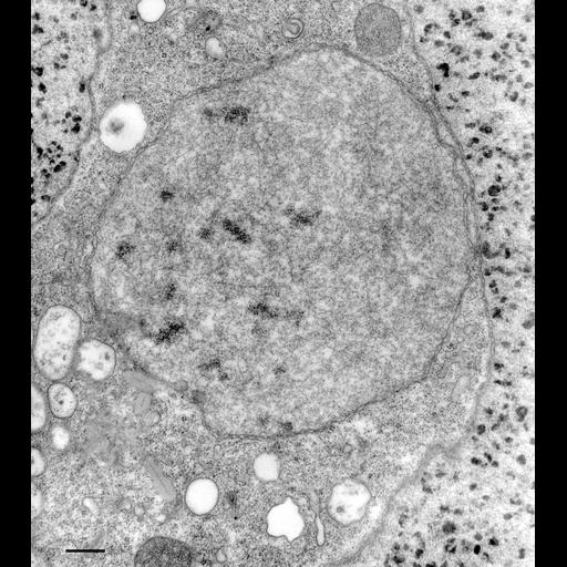  NCBI Organism:Paramecium multimicronucleatum; Cell Types:cell by organism, eukaryotic cell, , ; Cell Components:pronucleus, macronucleus, cytoplasm; Biological process:pronuclear migration, macronucleus organization, cytoplasm organization;